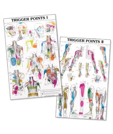 Deux affiches anatomiques côte à côte, « Trigger Points I » et « Trigger Points II », montrant des zones colorées sur des silhouettes humaines